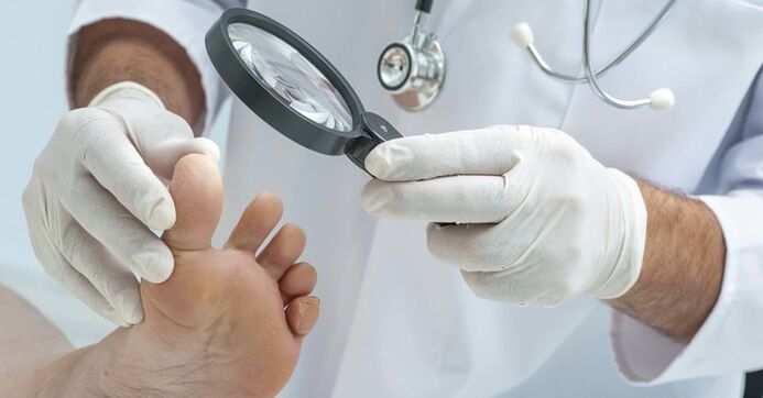 Examinarea diagnostic a unghiilor de la picioare