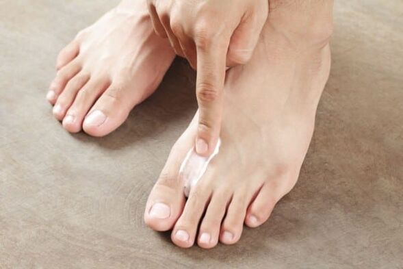 aplicarea de unguent din ciuperca pielii de pe picioare