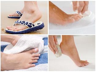 ciuperca de piele de la picioare prevenirea